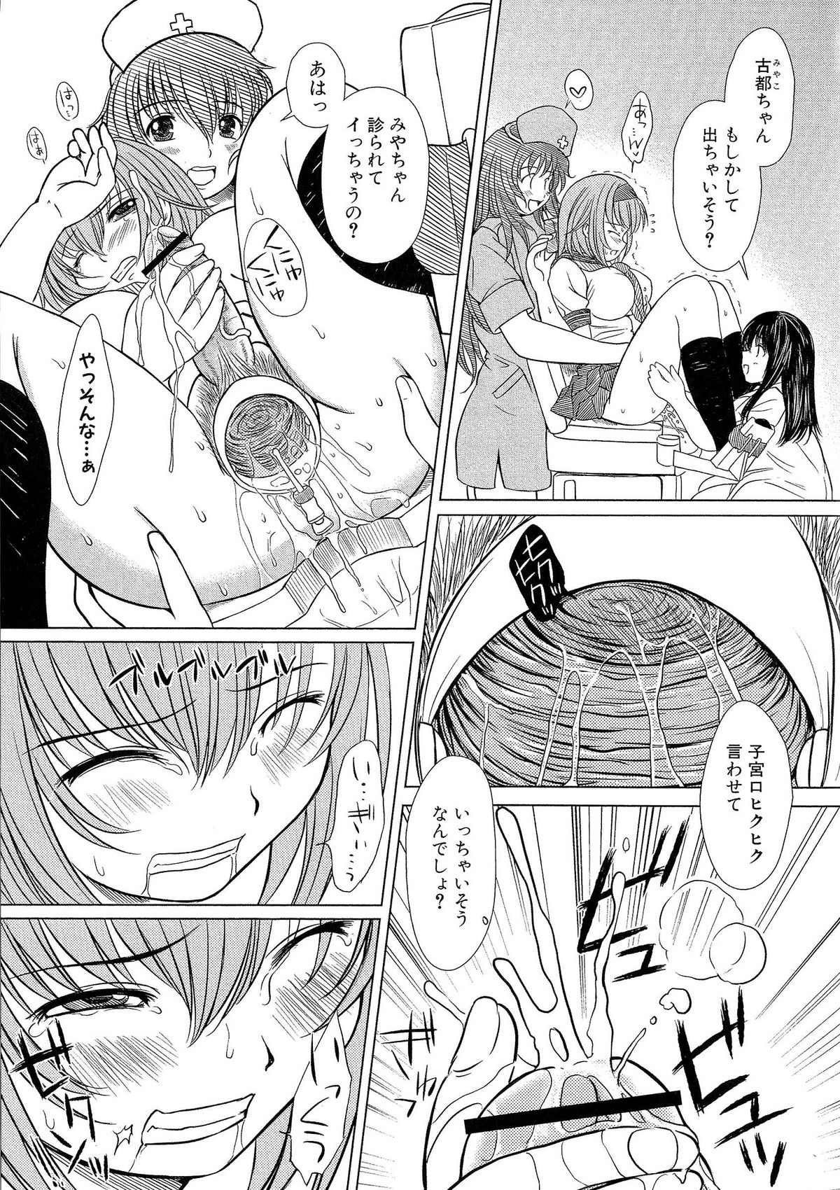 [えにぐま] 欠損少女 下
